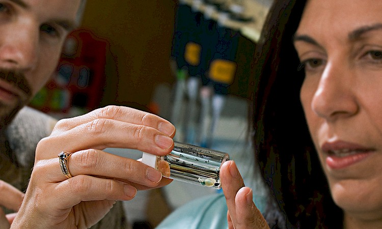 Deep Brain Stimulation