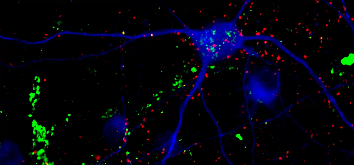 hero-harnessing-exosomes-as-a-therapeutic-for-rett-syndrome