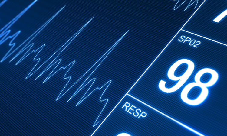 Biosensors