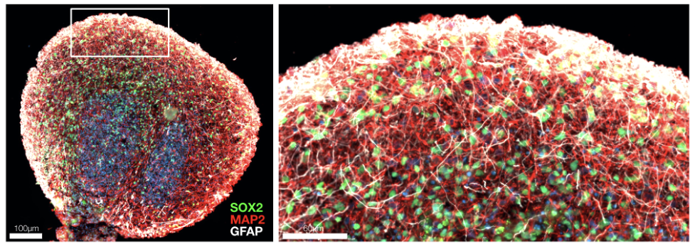 Organoids figure 1